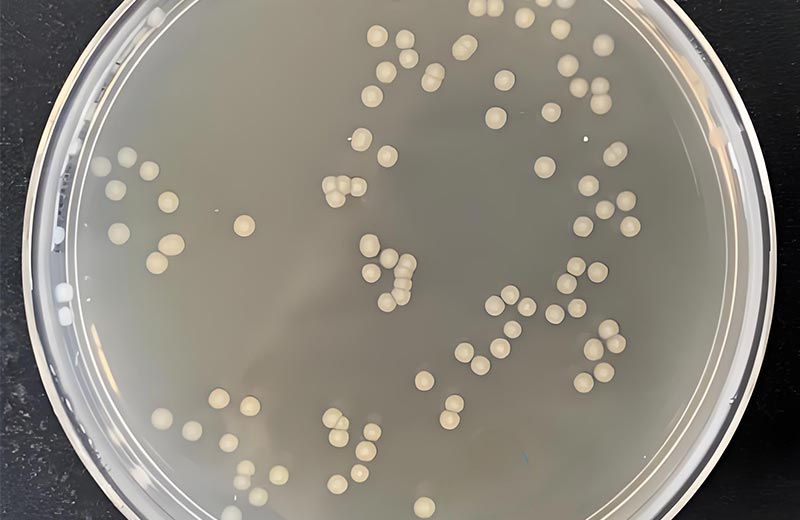 微生物菌落總數(shù)檢測(cè)為何需48小時(shí)培養(yǎng)？